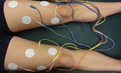 3,2 Cm Kablolu Yuvarlak Elektrot