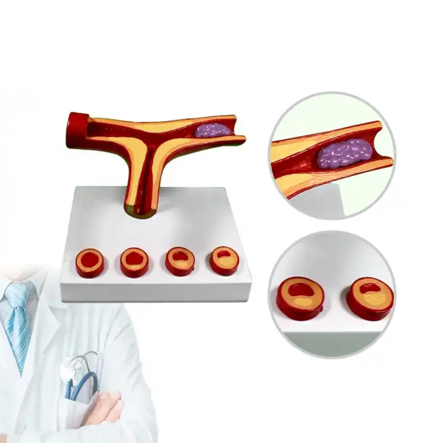 Damar Tıkanıklığı Model 46