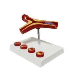 Damar Tıkanıklığı Model 46